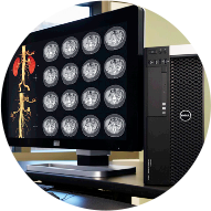 Dell precision workstation showing CT-scan and MRI of a patient